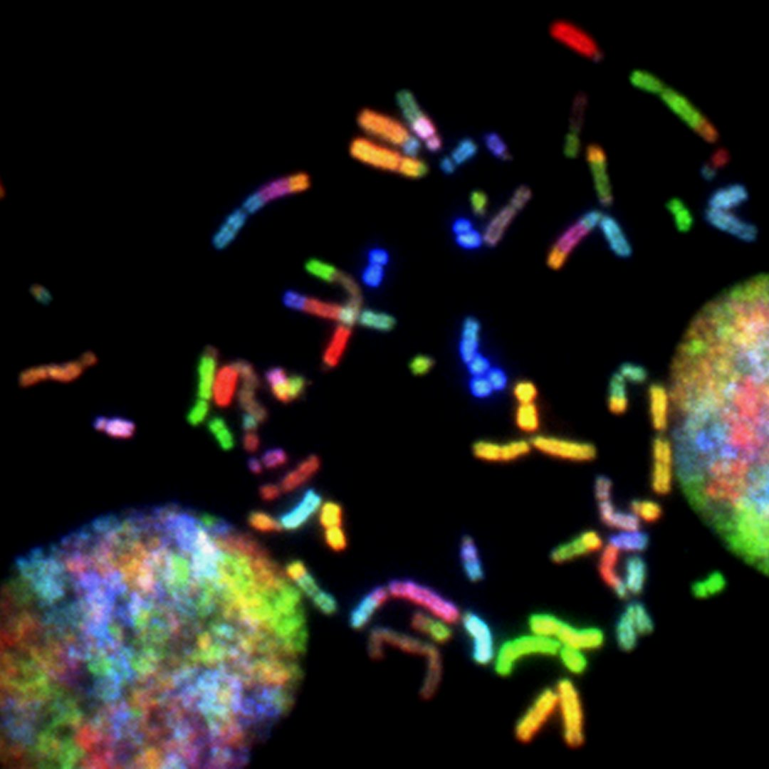 New Metabolic Pathway Unveiled: αKG-Carnitine Axis Drives DNA Repair and Influences Cancer Treatment Response