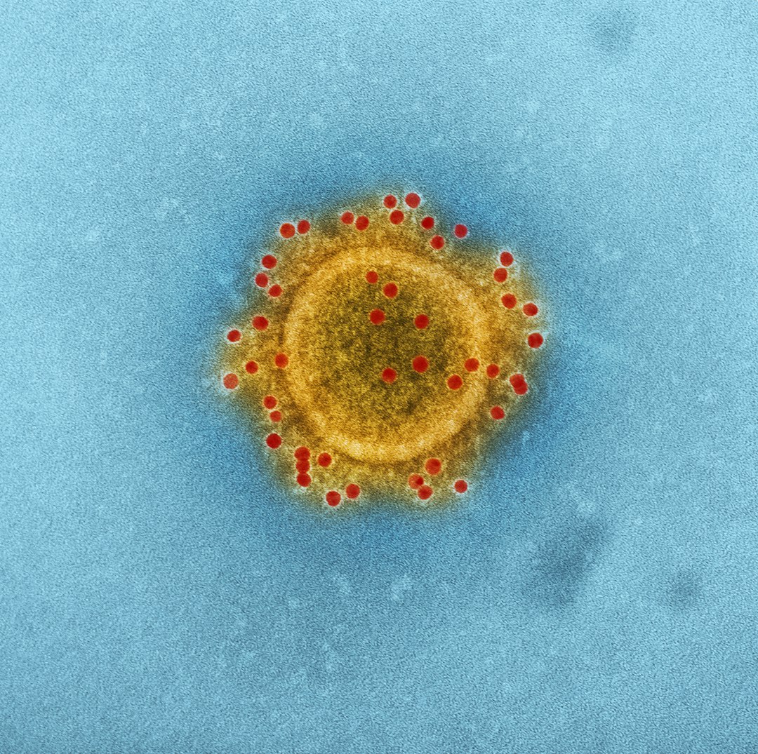 The Unyielding Ebola Outbreak: A Catastrophic Collision of Disease and Conflict